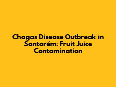 Chagas Disease Outbreak in Santarém: Fruit Juice Contamination
