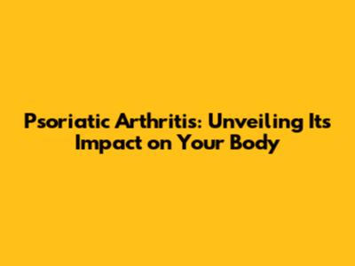 Psoriatic Arthritis: Unveiling Its Impact on Your Body